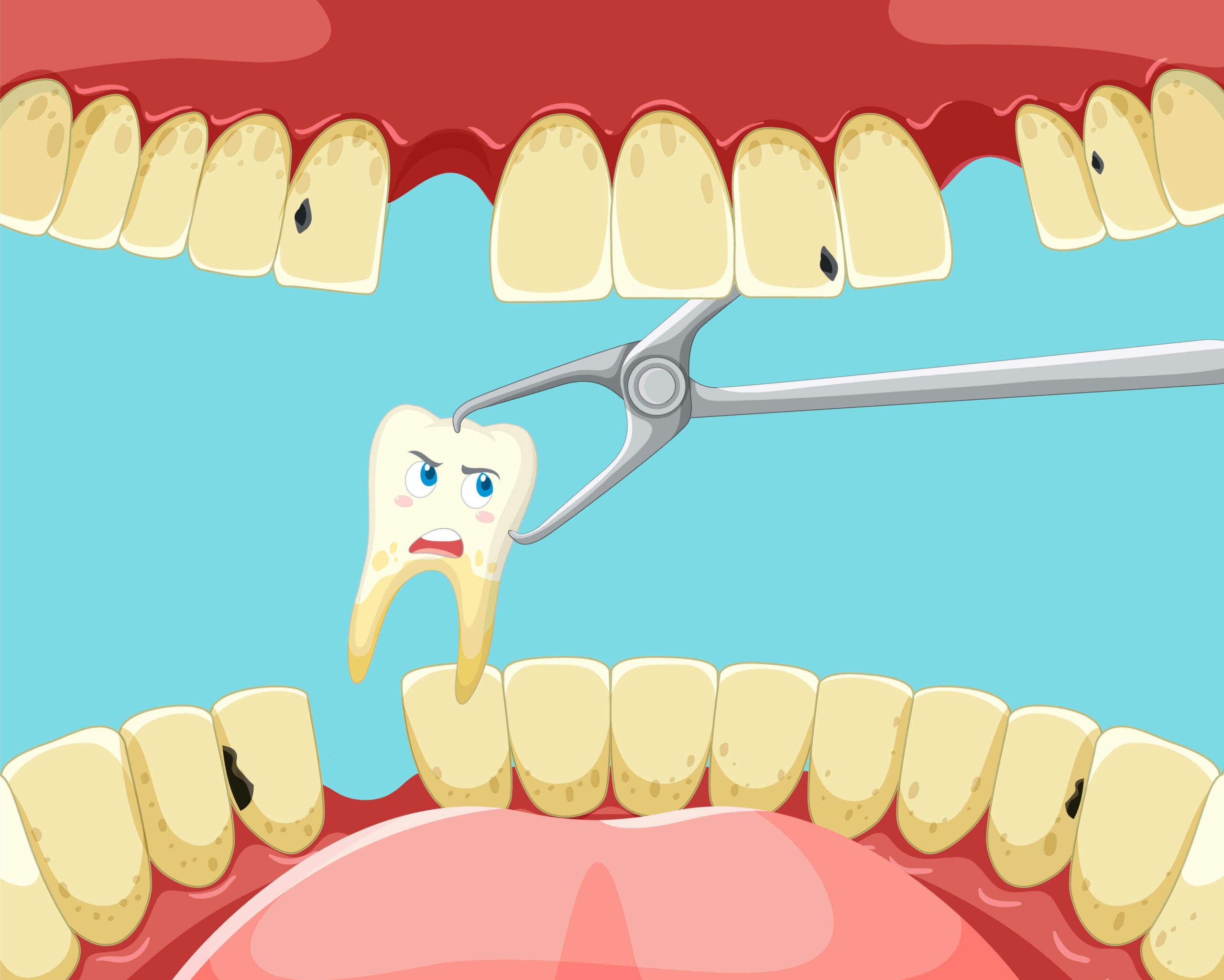 Cracked Tooth